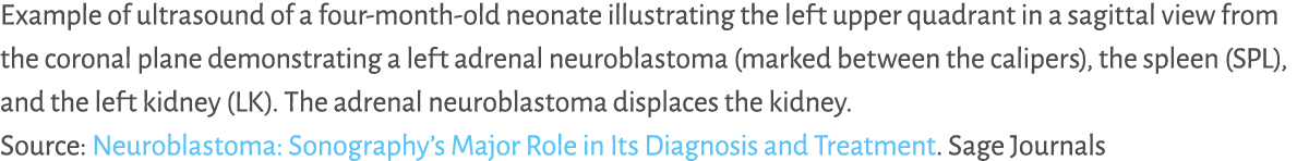 Example of ultrasound of a four month old neonate illustrating the left upper quadrant in a sagittal view from the co...