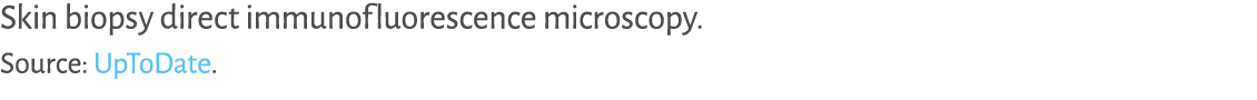 Skin biopsy direct immunofluorescence microscopy. Source: UpToDate.