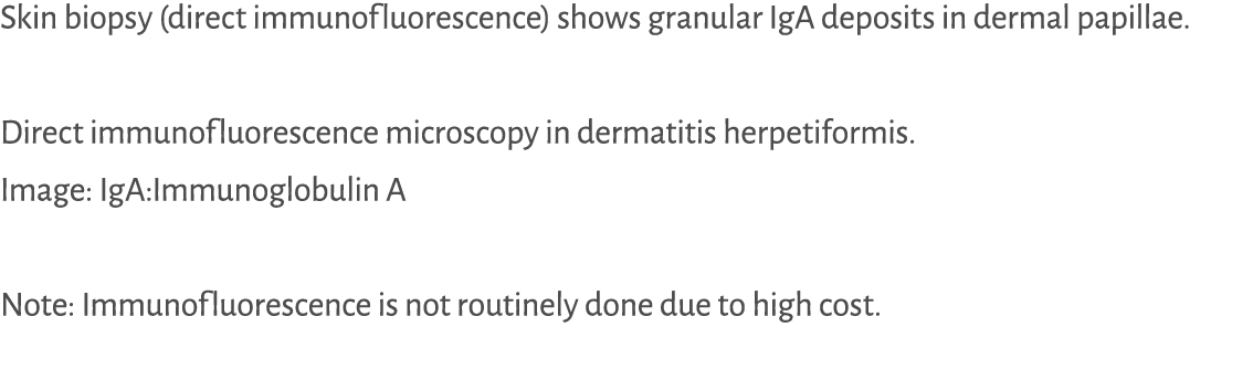Skin biopsy (direct immunofluorescence) shows granular IgA deposits in dermal papillae. Direct immunofluorescence mic...
