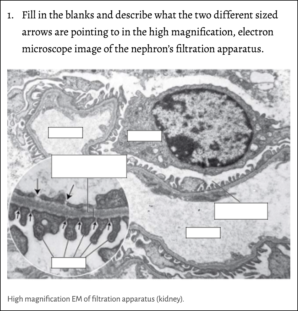 1. Fill in the blanks and describe what the two different sized arrows are pointing to in the high magnification, ele...
