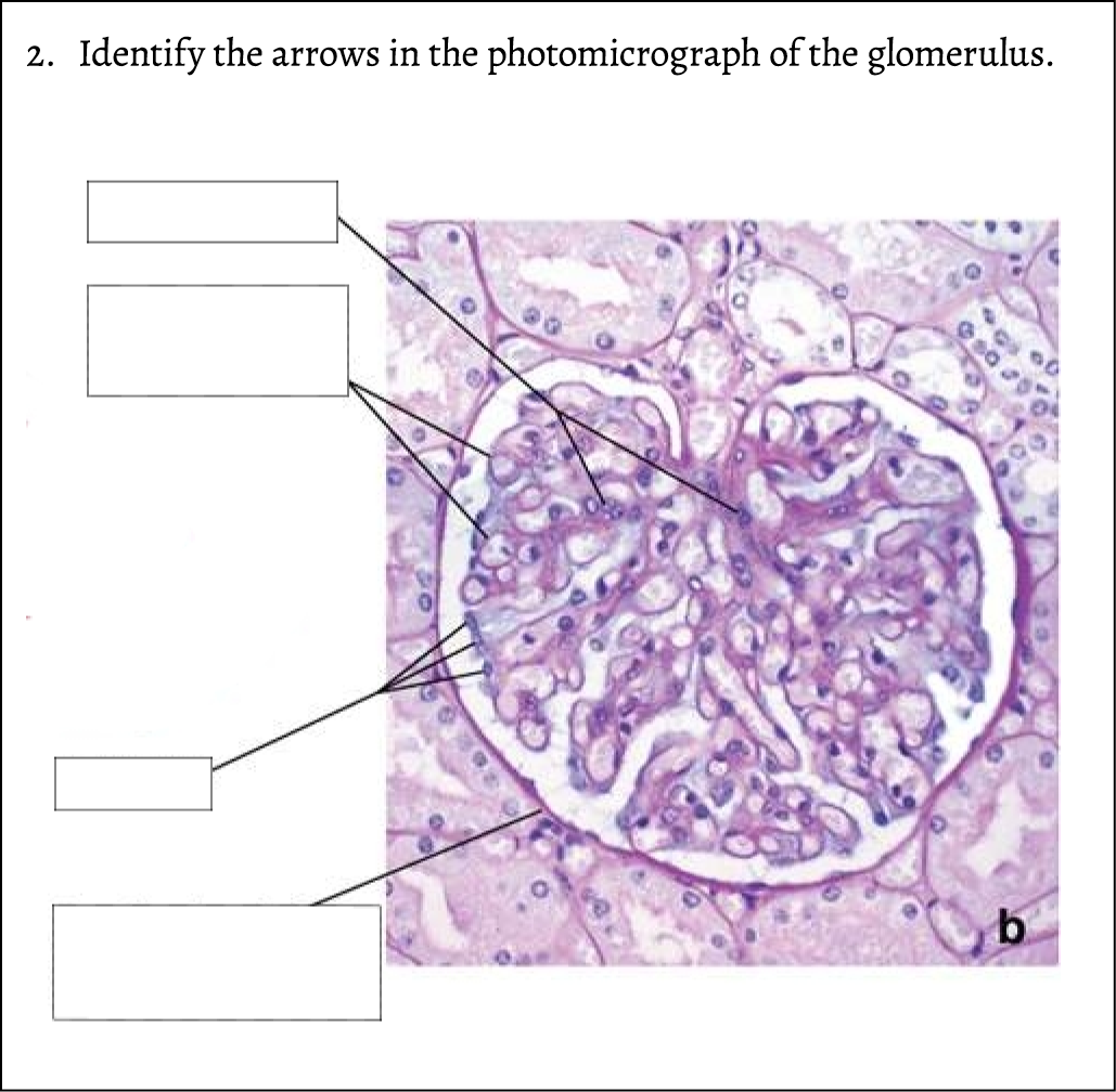 2. Identify the arrows in the photomicrograph of the glomerulus. ￼ 